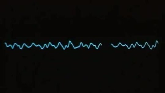 Kent Fire Department CPR Respnse